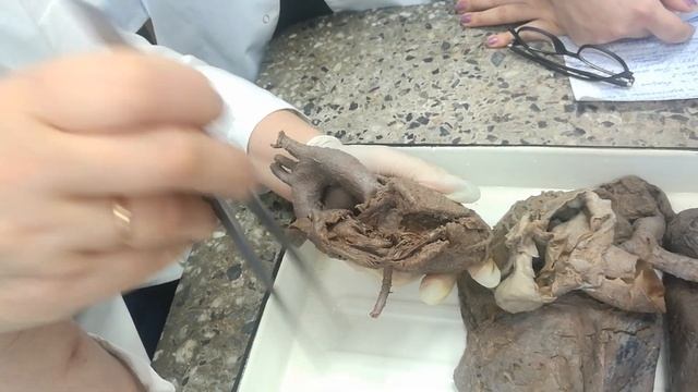 Анатомия | Сердце смотреть онлайн