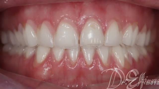 Хирургическое, ортодонтическое и эстетическое лечение без боли и эмоционального дискомфорта в Москв смотреть онлайн