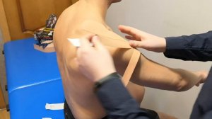 Наложение кинезио тейпа при синдроме замороженого плечя