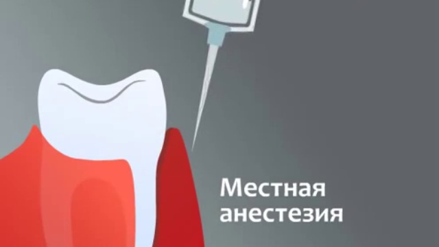 Лечение десен аппаратом Вектор (Vector)