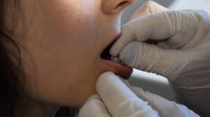 прокол губы