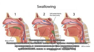 Что делать, если пища застряла в горле