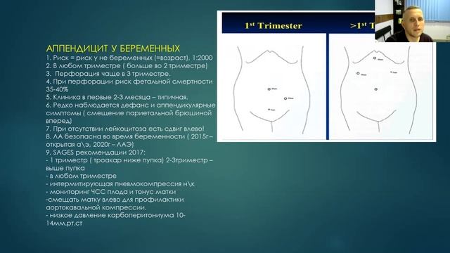 Карлов: Острый аппендицит. Современные тенденции смотреть онлайн