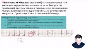 ЭКГ за 100 минут №5: Нарушение проводимости на ЭКГ