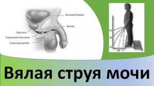 Вялая струя мочи.