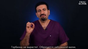 Костная мозоль при ринопластике