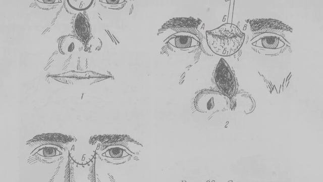 Самых опасные точки на теле человека смотреть онлайн