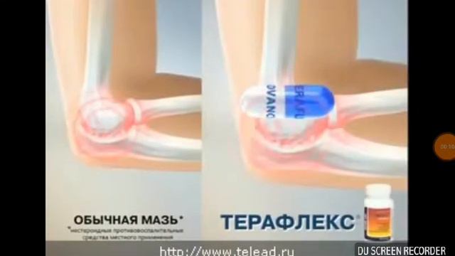 L-терафлекс смотреть онлайн