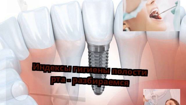 Индексы гигиены полости рта - разбираемся смотреть онлайн