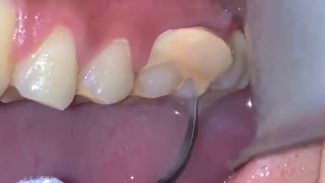 Personal Care and Oral Health смотреть онлайн