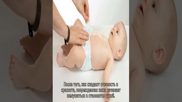 Шершавая кожа у ребенка на руках, ногах, теле — возможные причины