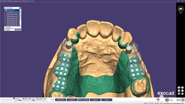 INSIGHTS 2018: PartialCAD Case Demonstration - Bridge with attachments and partial Part II смотреть онлайн