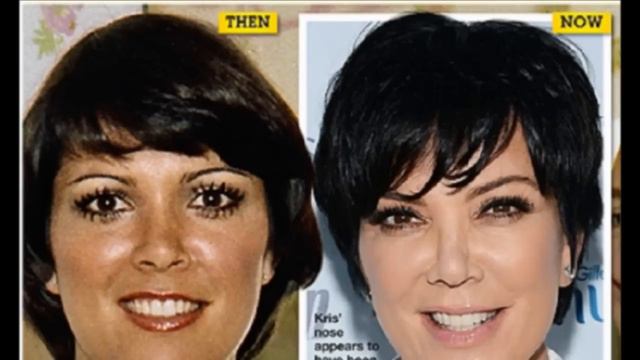 49 Celebrities Before and After Plastic Surgery смотреть онлайн