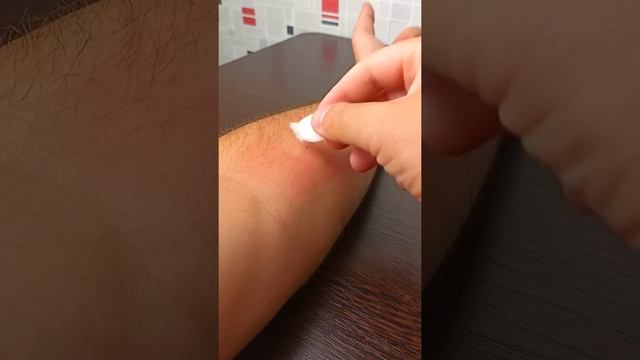 Как избавиться от укуса муравья пули. Самый болезненный укус. смотреть онлайн