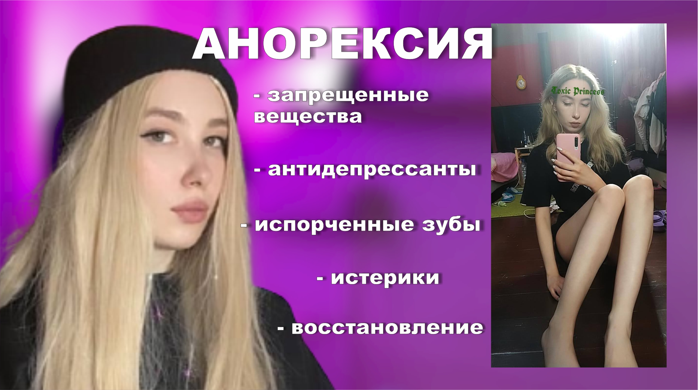 АНОРЕКСИЯ РПП // моя история смотреть онлайн