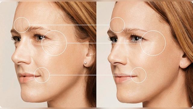 Патчи с гиалуроновой кислотой смотреть онлайн