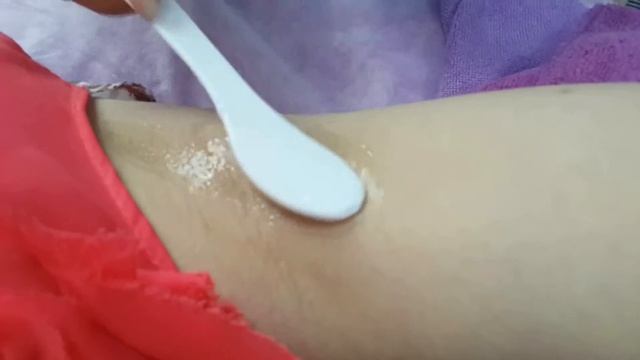 808nm Diode Laser Intro And Opera