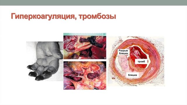 Лекция "Введение. Гомеостаз. Физико-химические свойства крови. Система гемостаза. Группы крови" смотреть онлайн