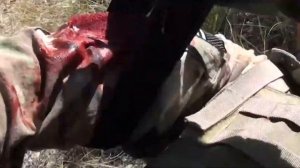 Оказание первой медицинской помощи при ядерном взрыве.