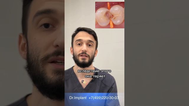 Почему доктор предлагает поменять старую пломбу?! #пломба #терапевт #зубы #стоматологиямосква