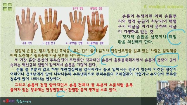 손따기18강. 제2의 두뇌. 손 안에 모든 질병이 보인다. Second brain. Hand acupressure story. смотреть онлайн