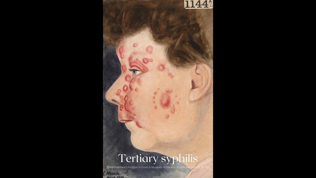 TUDOR ROYAL FERTILITY PROBLEMS. Royal childbirth experiences. Producing a male heir. History Callin смотреть онлайн