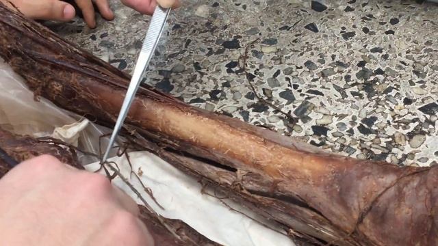 бедренная артерия ( Done by Dr. thaer al nahlawi +79814048868 ) смотреть онлайн