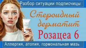РОЗАЦЕА 6. Не повторяйте чужие ошибки (эти мази под запретом)! План действий при ДЕРМАТИТЕ.