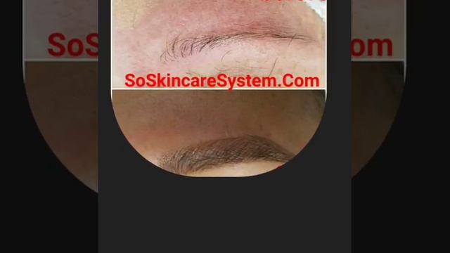 eyebrows, microblading, permanentmakeup, beauty, makeupartist, 3dareola, scalppigmentation, microne смотреть онлайн