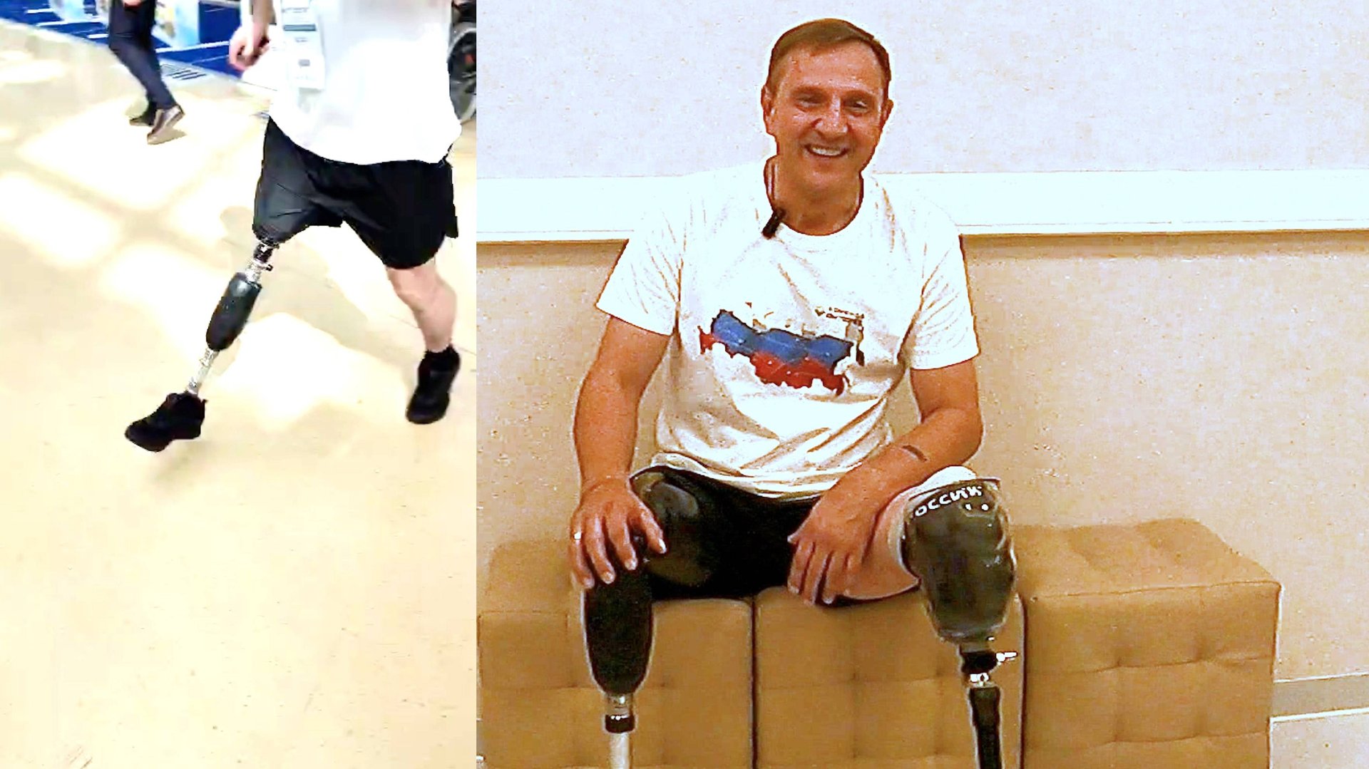 Какие протезы ног мне сделали в мастерской "Антарес Фит" смотреть онлайн