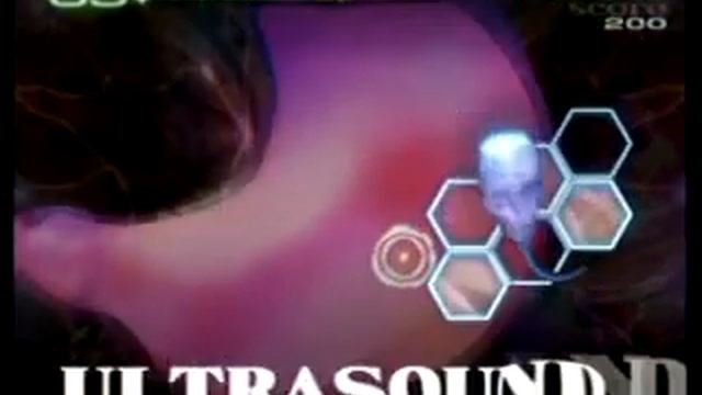 Introduction - Trauma Center: Second Opinion (Wii) смотреть онлайн