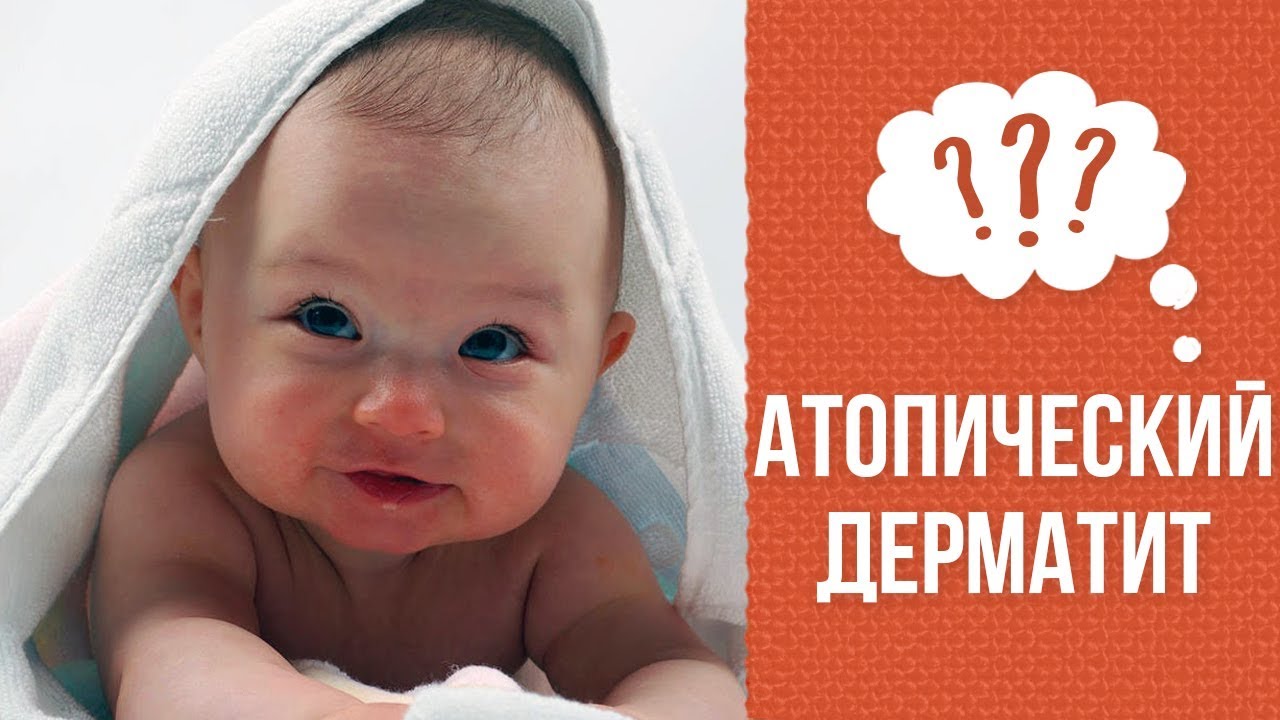 Почему возникает атопический дерматит смотреть онлайн