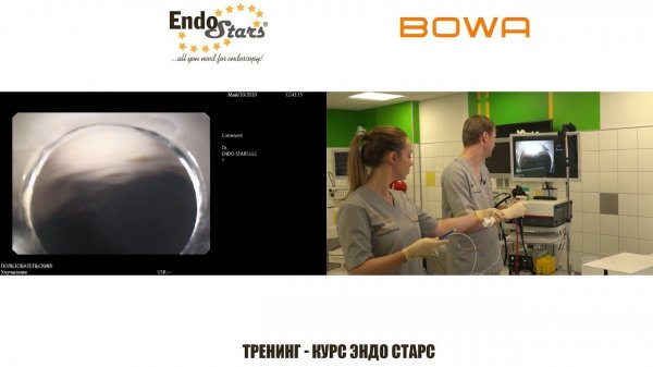 Эндоскопическая подслизистая диссекция (ESD).Эндоскопический курс. Эндо Старс (Endo Stars LLC).