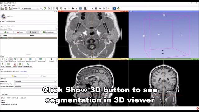 Quick Manual Segmentation With Contour Interpolation