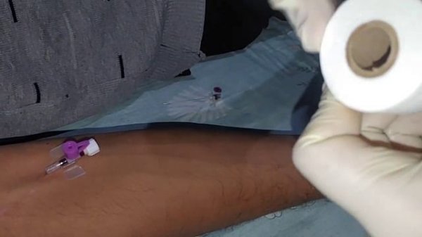 венозный катетер. как правильно установить венозный катетер