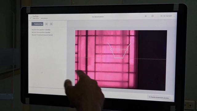 The New Visumax 800 Laser for ReLEx SMILE pro смотреть онлайн