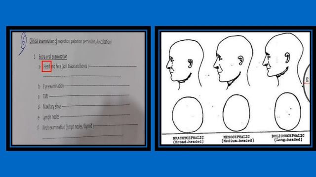 Case sheet of Oral and Maxillofacial department смотреть онлайн