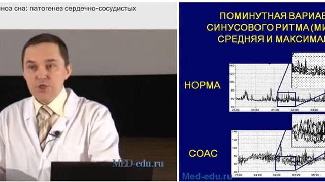2_Синдром обструктивного апноэ сна: патогенез сердечно сосудистых осложнений. Р.В. Бузунов смотреть онлайн