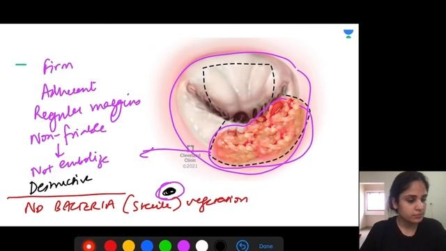 Mission FMGE Medicine in 10 Days :Cardiology | Let's Crack NEET PG | Dr.Jhanvi Bajaj смотреть онлайн