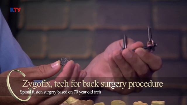 Innovation Israel - Zygofix, tech for back surgery procedure смотреть онлайн
