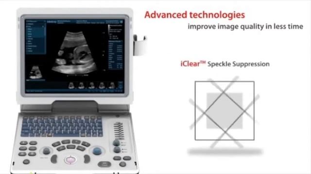 УЗИ аппарат Mindray DP 50 смотреть онлайн