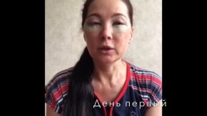 Реабилитация. День первый и второй после круговой блефаропластики.