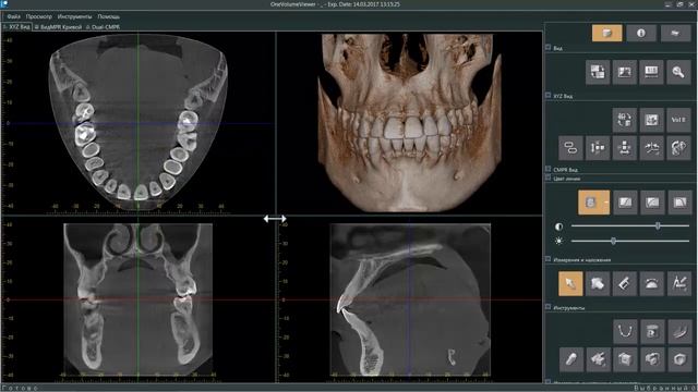 Основные инструменты для визуализации в One Volume Viewer смотреть онлайн