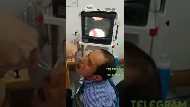 Еда в носу смотреть онлайн