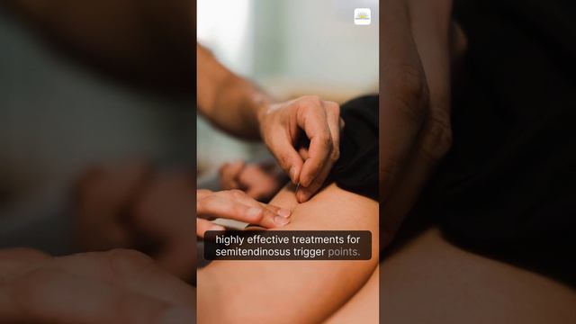 Acupuncture for Semitendinosus Muscle Pain смотреть онлайн