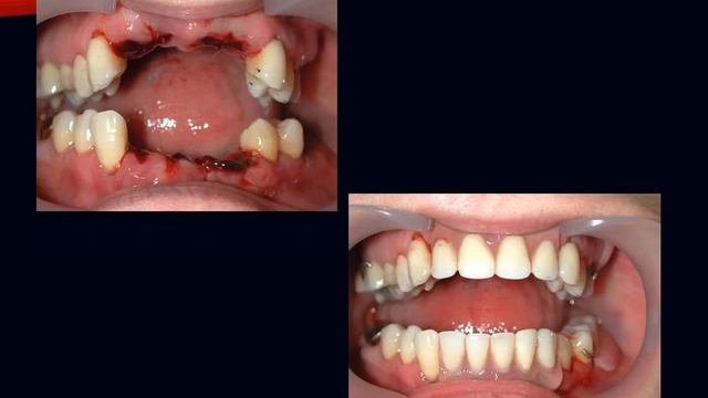 Семинар " Болезни пародонта" смотреть онлайн