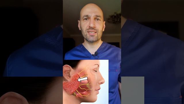 Киста околоушной слюнной железы, мукоцеле. смотреть онлайн