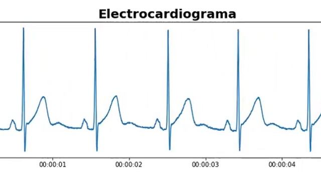 Animación electrocardiograma en Python - matplotlib.animation (Código en la descripción) смотреть онлайн