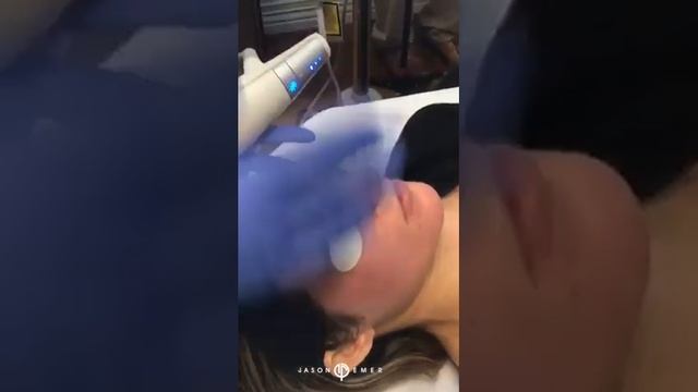 Clear & Brilliant Laser Facial | Skin Brightening and Rejuvenation | Live смотреть онлайн
