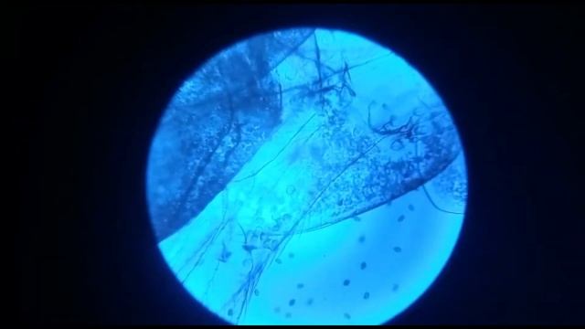 ИНФУЗОРИИ ТУФЕЛЬКИ ПОД МИКРОСКОПОМ. смотреть онлайн